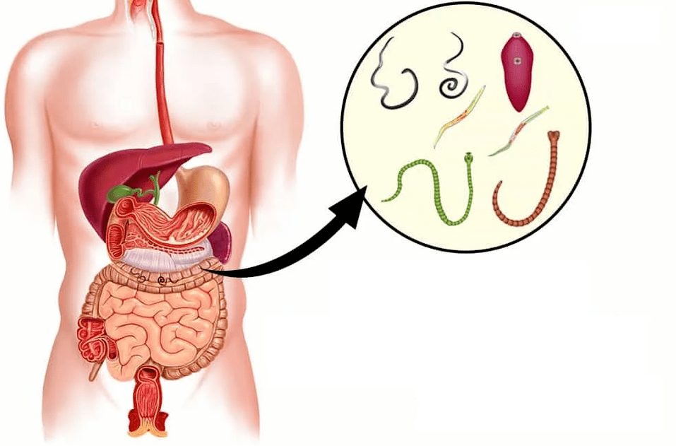 Helminți și viermi în tractul gastro-intestinal