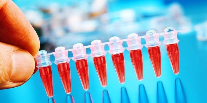 Test de sânge pentru a diagnostica prezența paraziților în intestine
