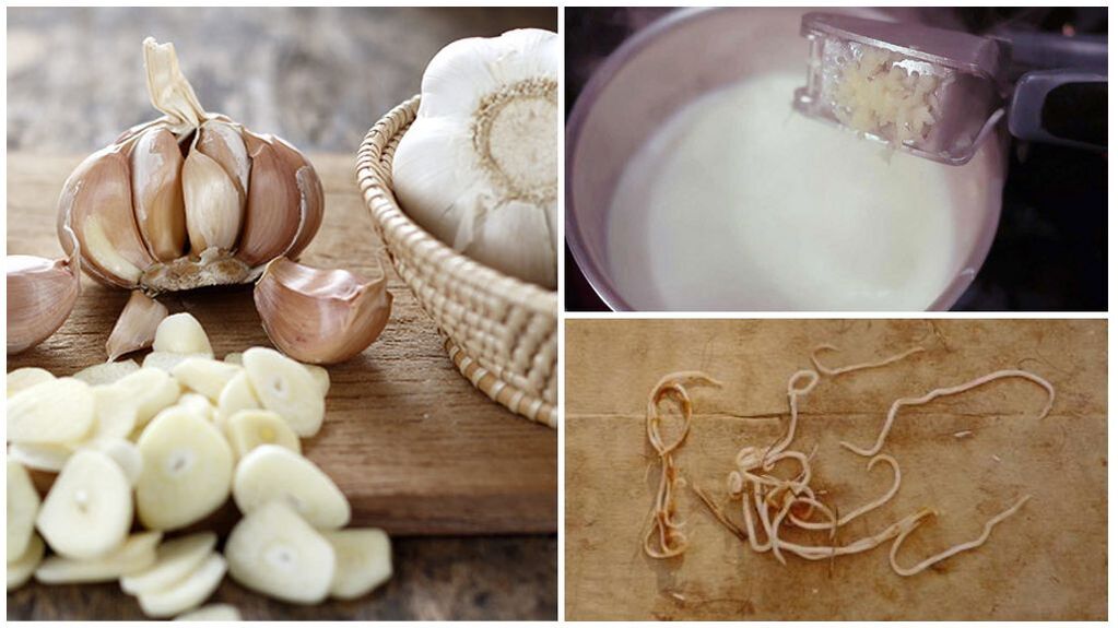 Lapte cu usturoi - un remediu popular pentru viermi la copii