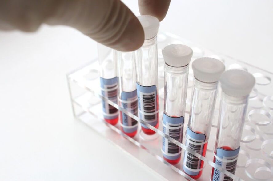 diagnosticul paraziților în organism