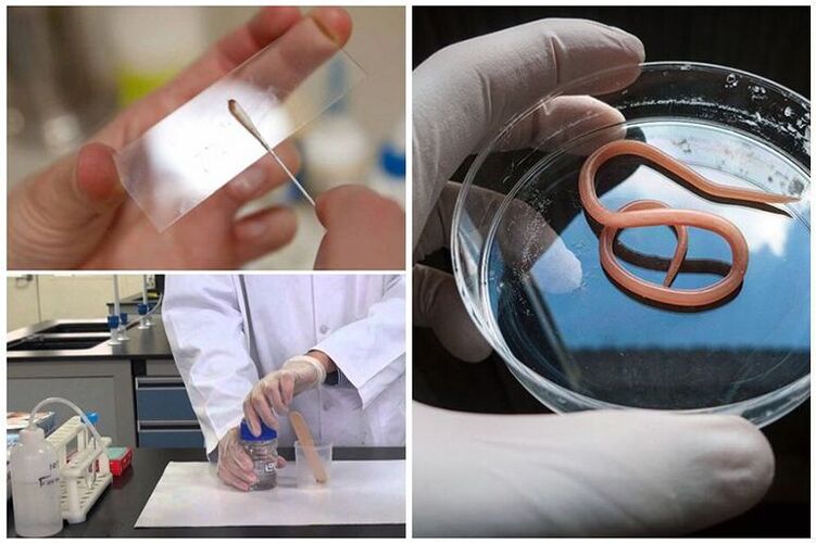 teste pentru prezența viermilor în organism