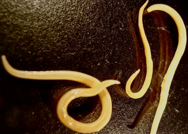 Viermi protozoari