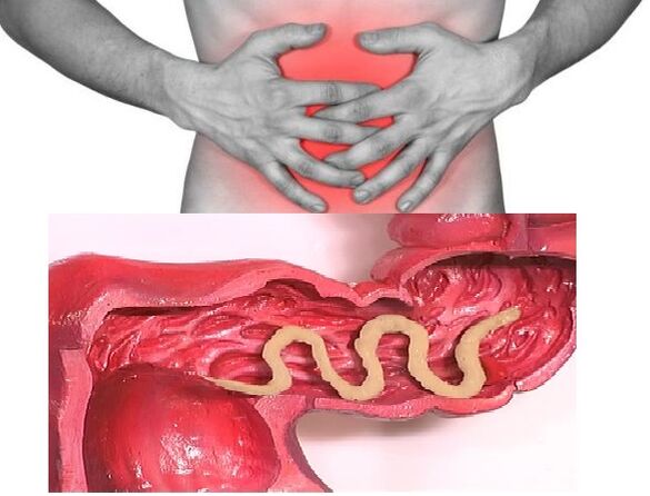 Viermii intestinali, Simptomele paraziților în tratamentul corpului uman
